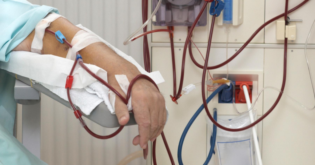 Image of a Dialysis prone kidney patient